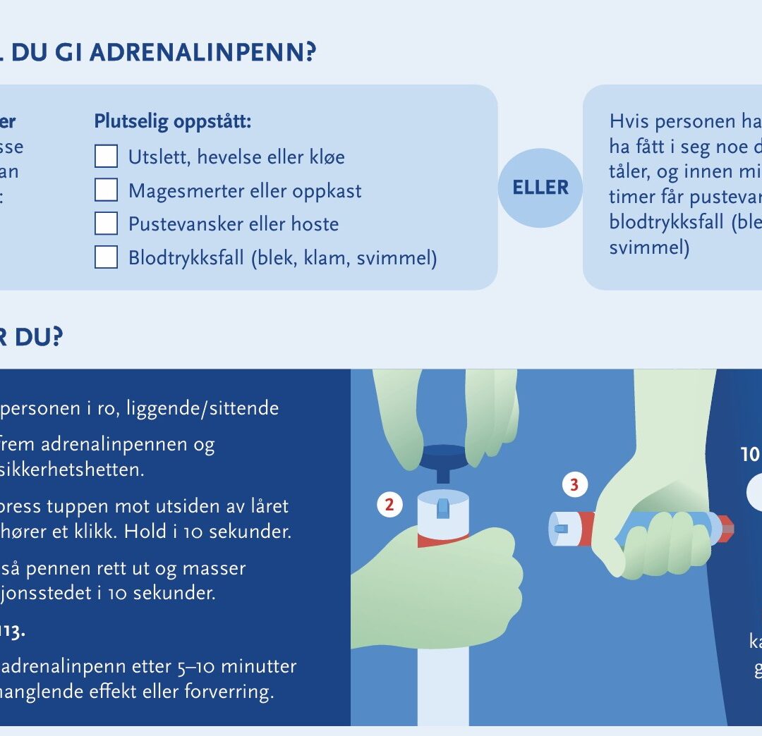 Anafylaksiplakaten er til bruk i barnehager, skoler og skolefritidsordning.